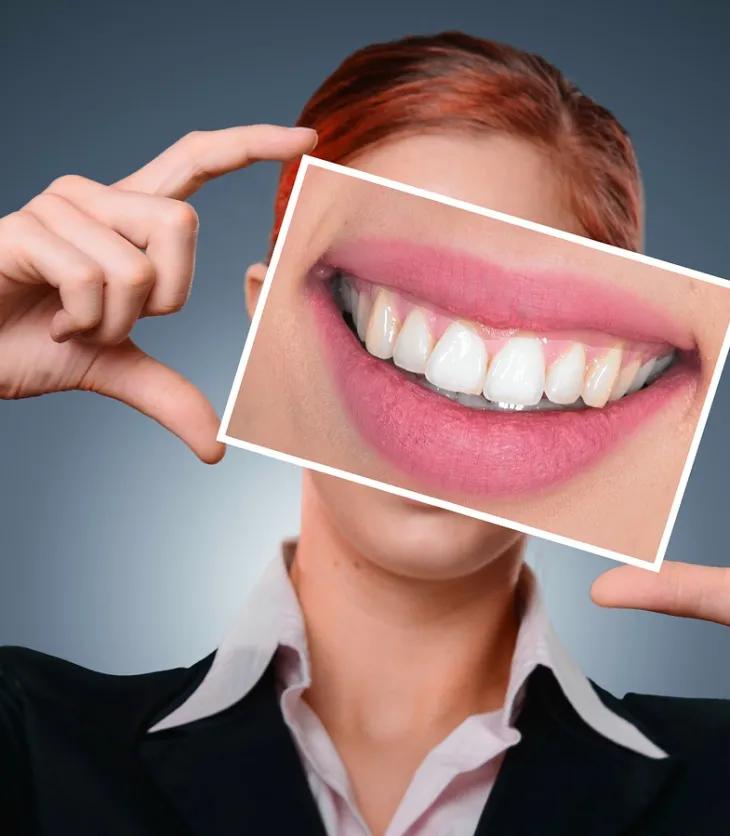 ¿Puedo tomar café después de una resina dental? - Cómo mantener la resina en los dientes puedo tomar café después de una resina - Cómo mantener la resina en los dientes