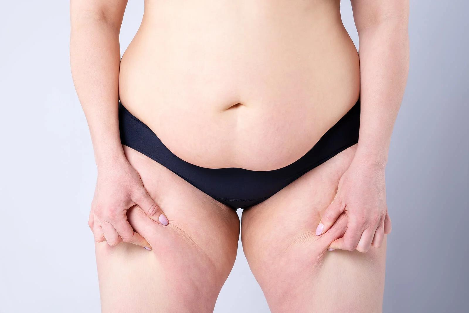 exfoliante de café para el abdomen - Cómo puedo eliminar el vientre caído