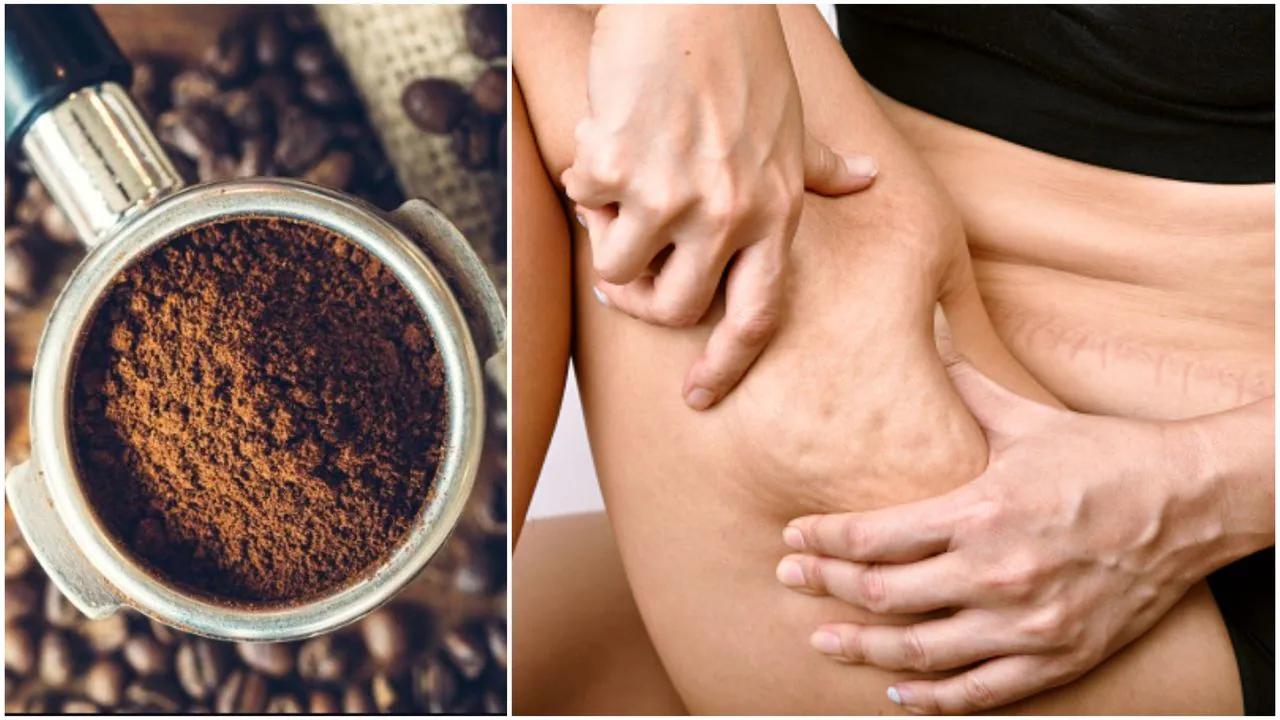 el cafe hace celulitis - Qué alimentos causan la celulitis