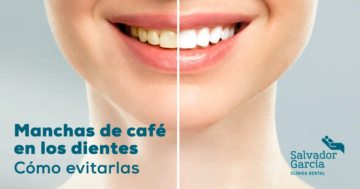 cafe en los dientes - Qué hacer para que el café no manche mis dientes