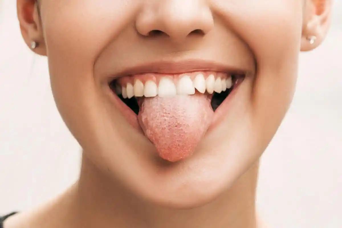 lengua cafe - Qué nos dice el color de la lengua