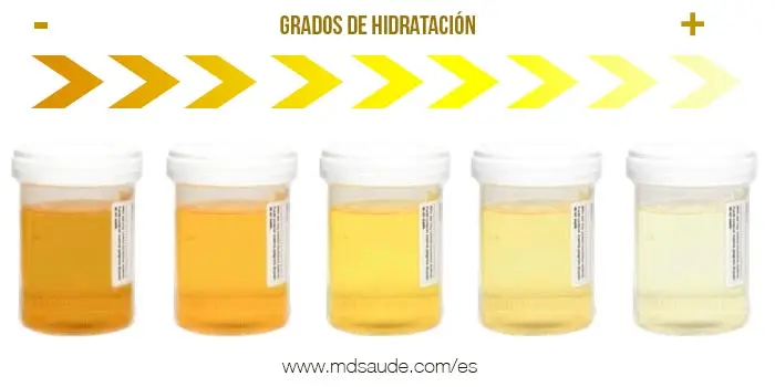 Mi orina huele a café: ¿Cuál podría ser la causa? - Qué nos dice el olor de la orina mi orina huele a cafe - Qué nos dice el olor de la orina