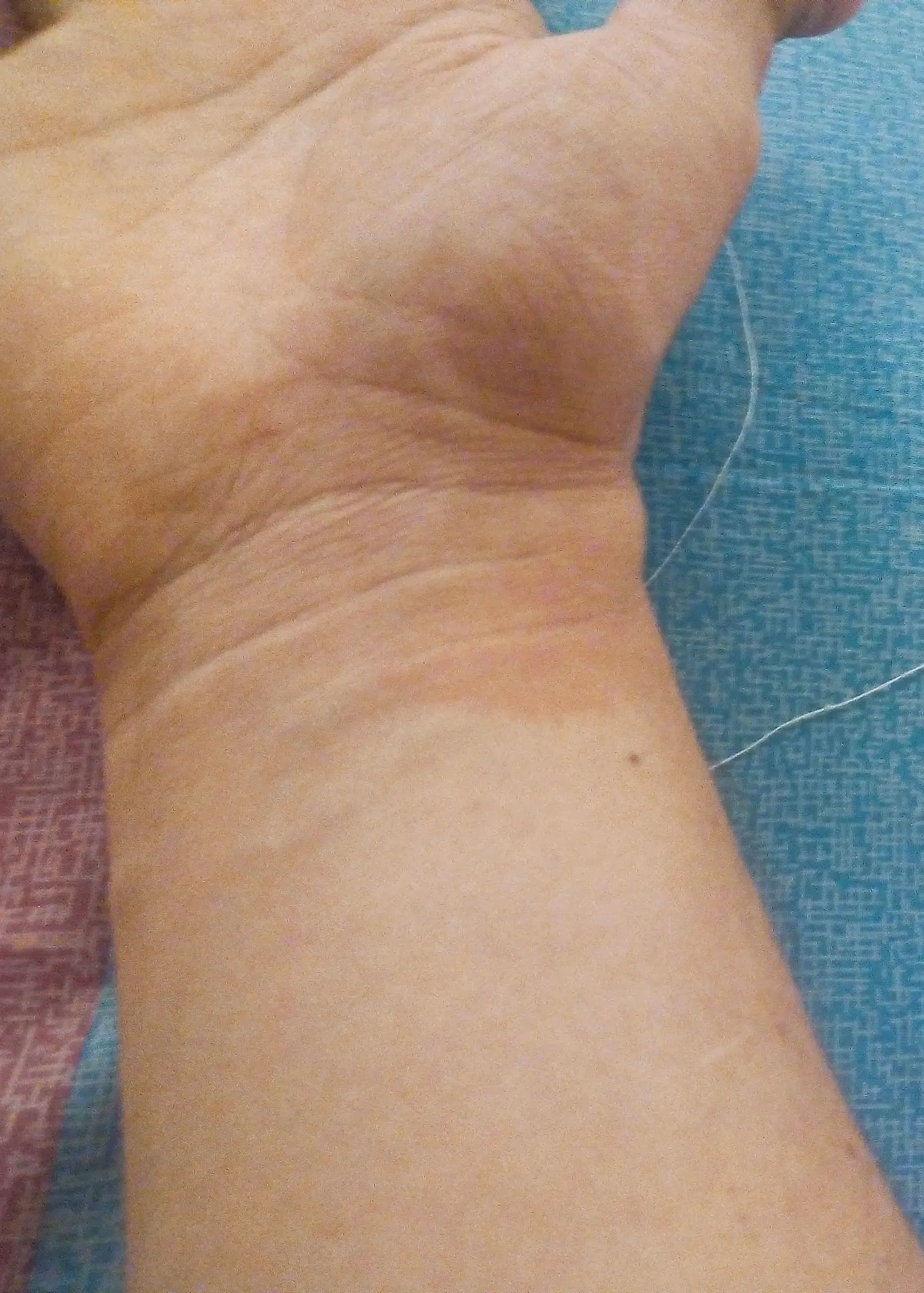 mancha cafe en la muñeca - Qué significa que te salga una mancha café en la mano