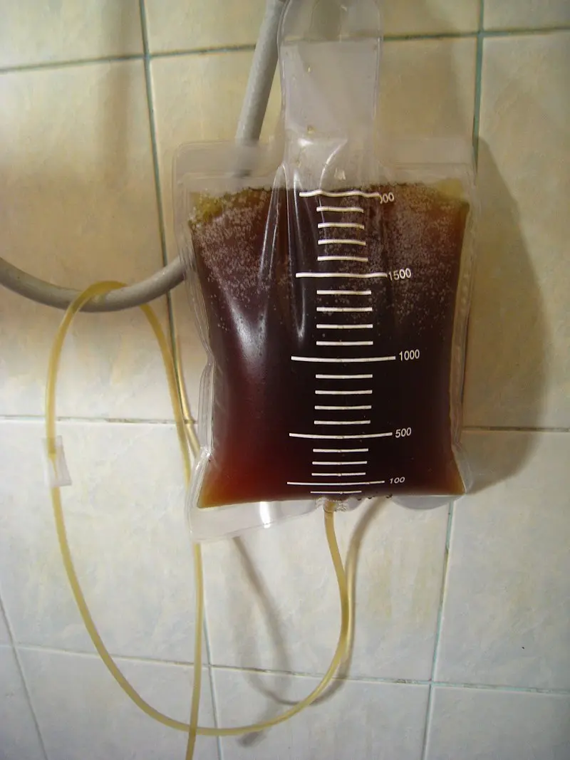enema con cafe - Qué tan recomendables son los enemas